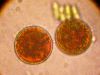 Одноклеточные микроскопические водоросли Haematococcus pluvialis