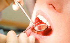 Стоматология в Израиле – лечение зубов в Израиле