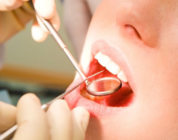 Стоматология в Израиле - лечение зубов в Израиле
